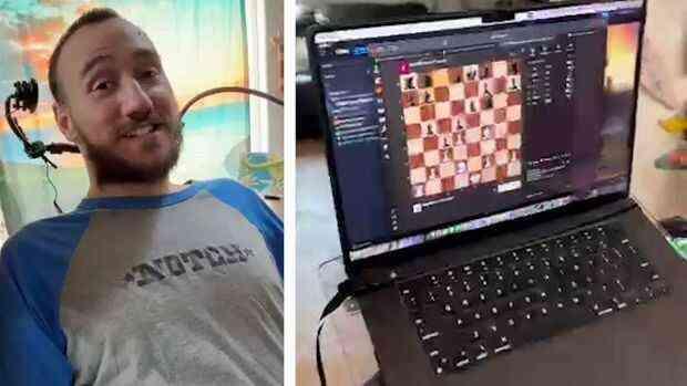 Neuralink beyin implantı yapılan felçli hasta, zihin gücüyle Civilization 6 oynadı