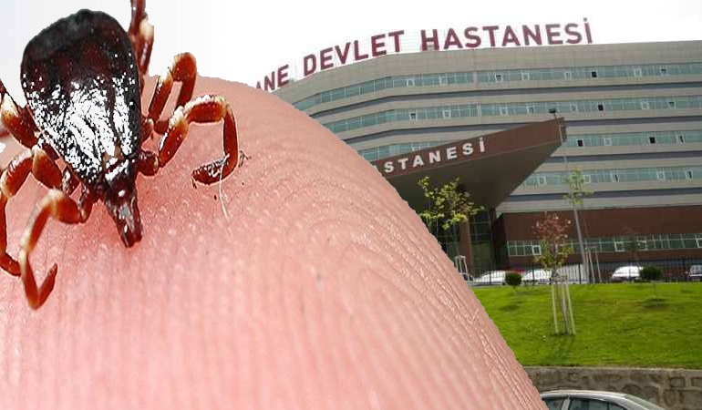 Kritik Uyarı: Keneyi Bekleme, Müdahale Et!
