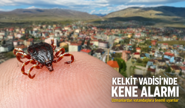 Kene Vakaları Artıyor, Riskli Bölgeler İçin Dikkat Çağrısı